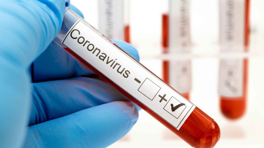 Coronavirus Pruebas
